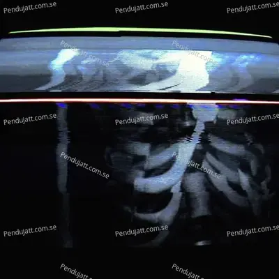 Carcass - Bones cover album